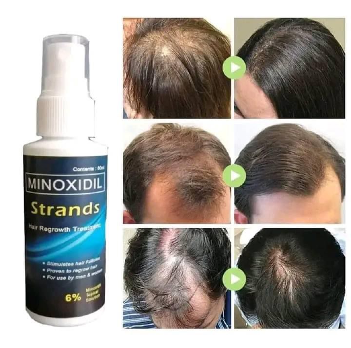 Minoxidil Strands Hair Regrowth Spray