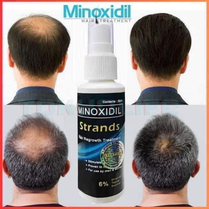 Minoxidil Strands Hair Regrowth Spray