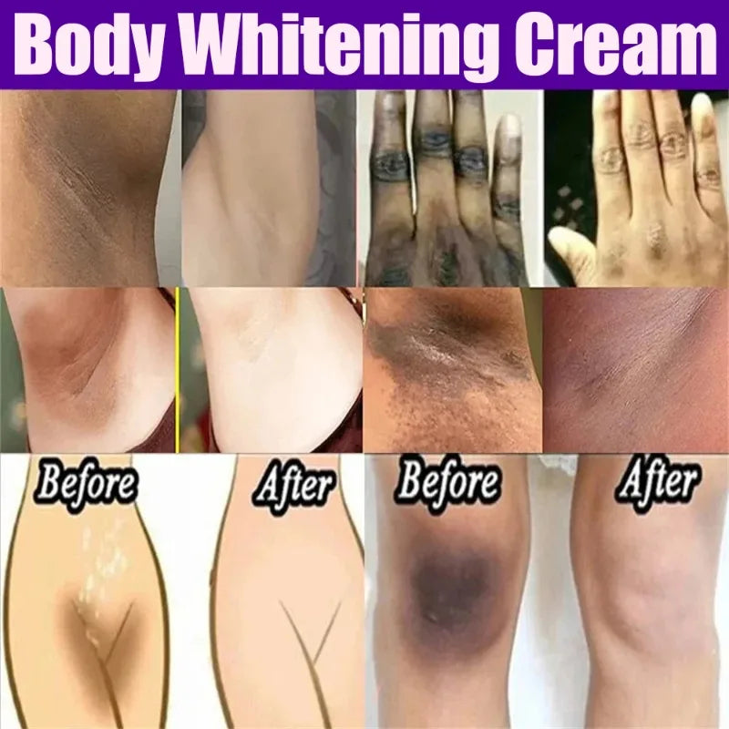 Brighten Cream For Dark Skin Bleaching Armpit Elbow Lightening Cream Intimate Area Woman Moisturizer Korean Skin Care Emulsion