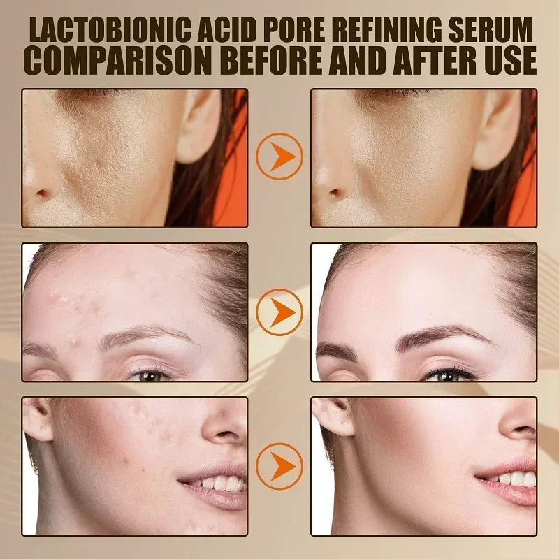 Lactobionic Acid Shrink Pores Facial Serum Firm Moisturizing Essence Liquid Repair Face Pores Beauty Skin Care Korean Cosmetics