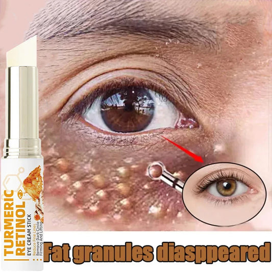 Fat Granules Removal Eyestick Anti-Puffiness Firming Cream Anti Inflammatory Fade Fine Line Repair Skin Barrier Korean Skin Care