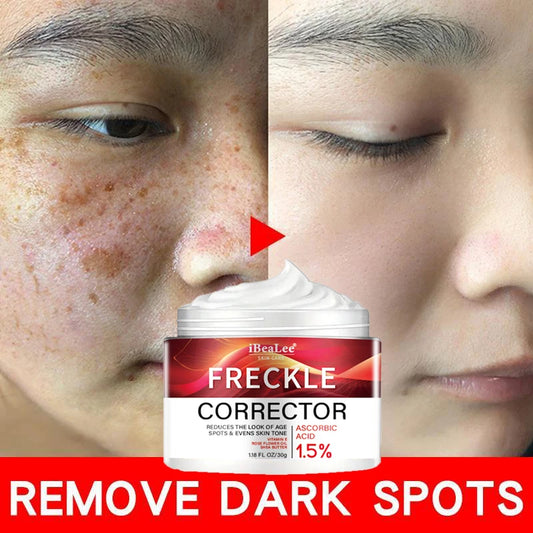 Freckle Whitening Cream Black Dots Melasma Remover Anti Brown Stain Lighten Pigmentation Moisturizing Skin Care Korean Products