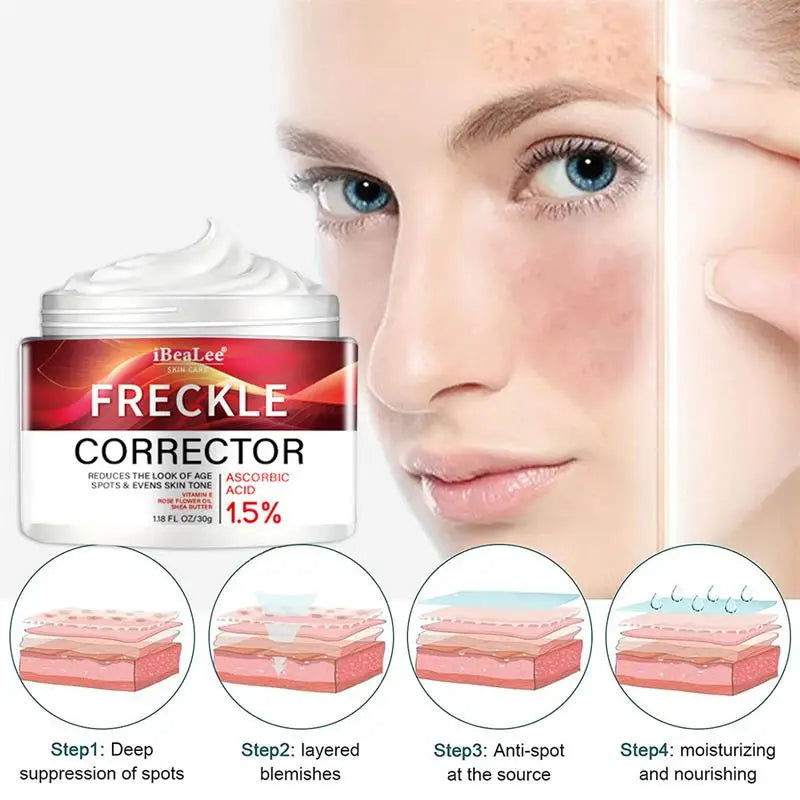 Freckle Whitening Cream Black Dots Melasma Remover Anti Brown Stain Lighten Pigmentation Moisturizing Skin Care Korean Products